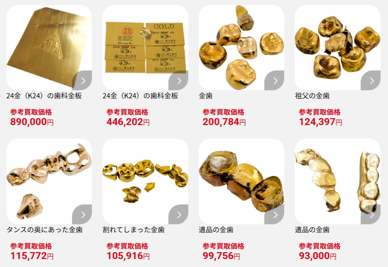 おたからや金歯買取相場